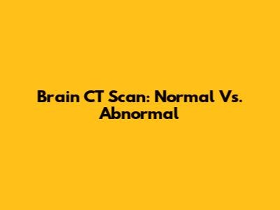 Brain CT Scan: Normal Vs. Abnormal