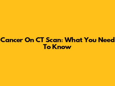 Cancer On CT Scan: What You Need To Know