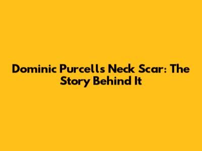 Dominic Purcell's Neck Scar: The Story Behind It