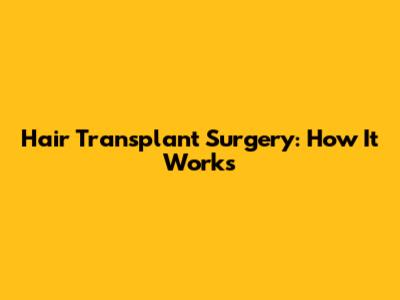 Hair Transplant Surgery: How It Works