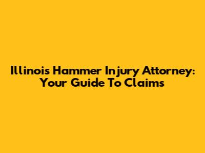 Illinois Hammer Injury Attorney: Your Guide To Claims