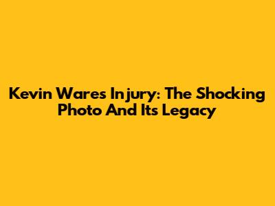 Kevin Ware's Injury: The Shocking Photo And Its Legacy