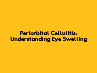 Periorbital Cellulitis: Understanding Eye Swelling
